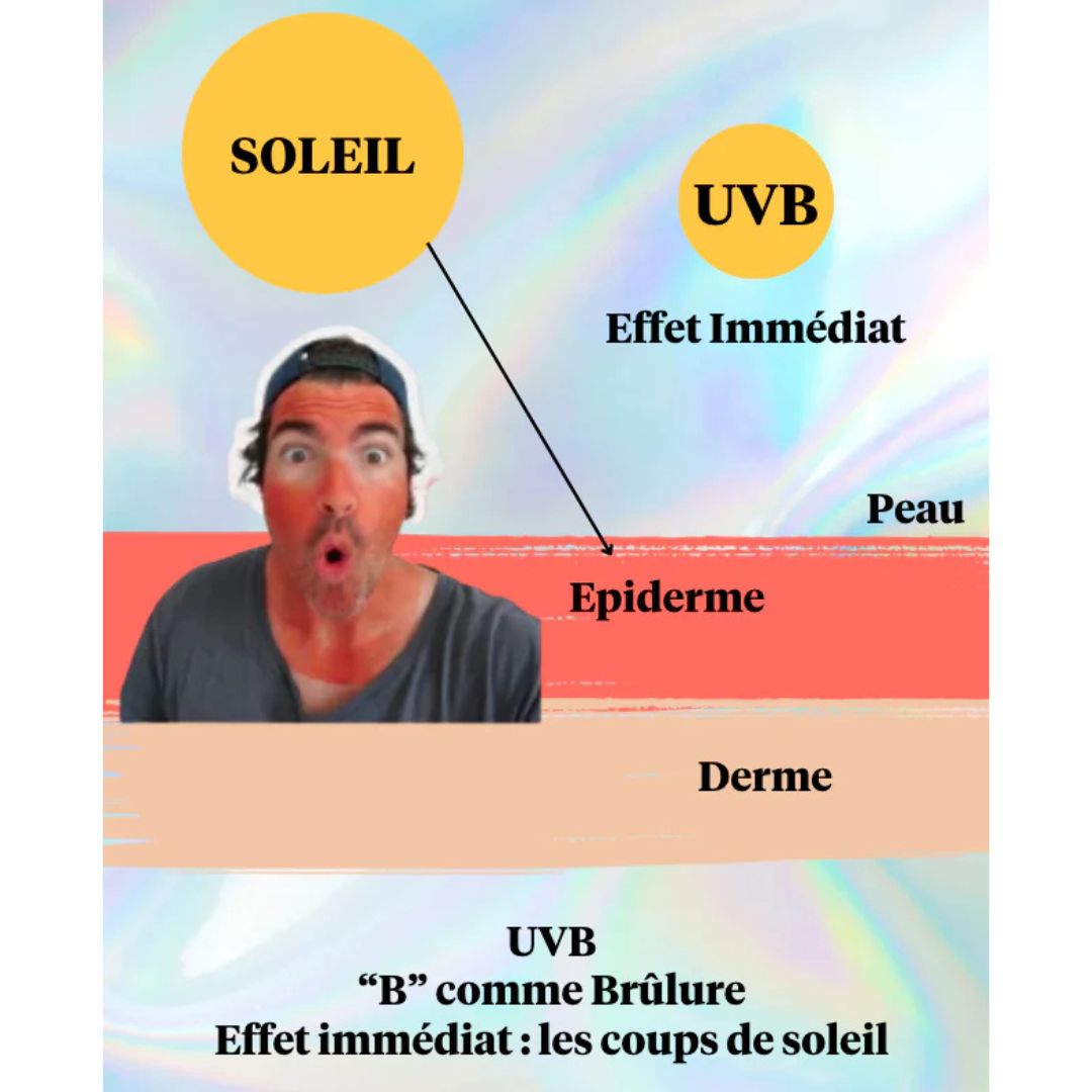 Infografía rayos UVB efecto quemaduras piel protección solar SPF50 rostro zonas sensibles.
